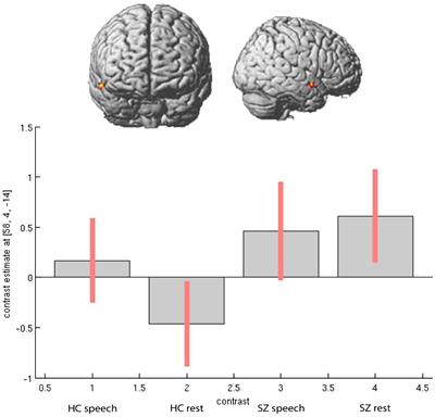 Neural activation during natural speech and rests in patients with schizophrenia and schizophrenia spectrum disorders—an fMRI pilot trial